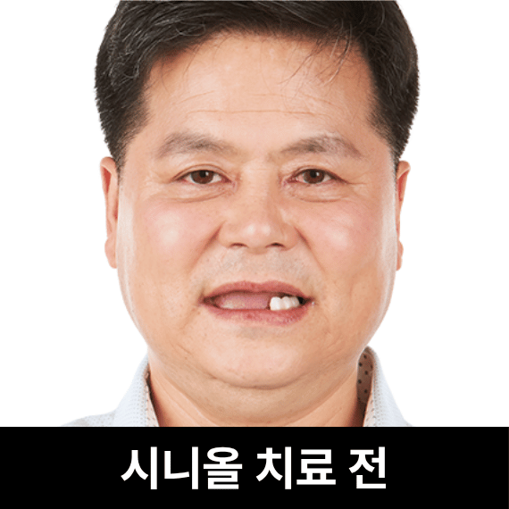 치료전