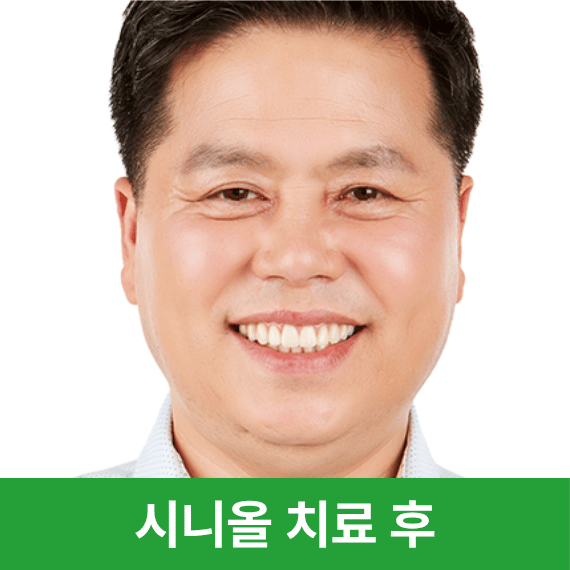 치료후