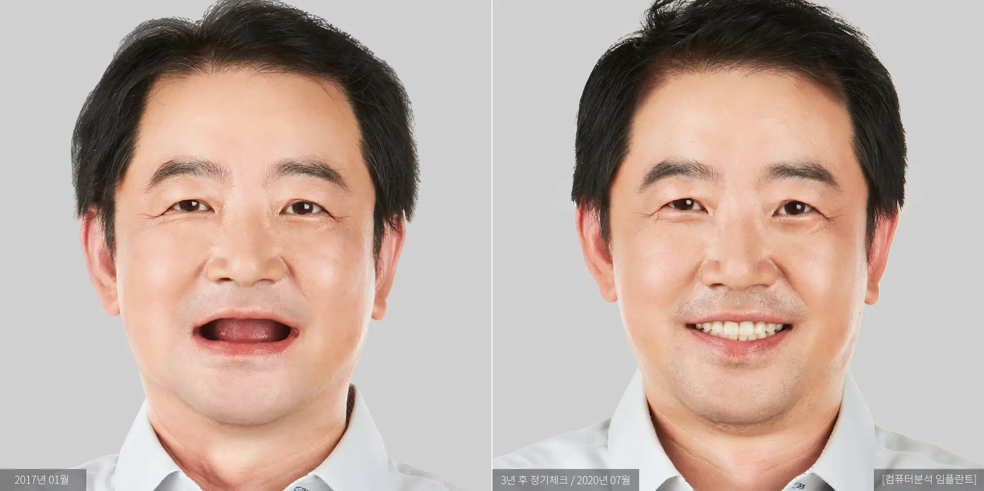 김옥동 전후 사진
