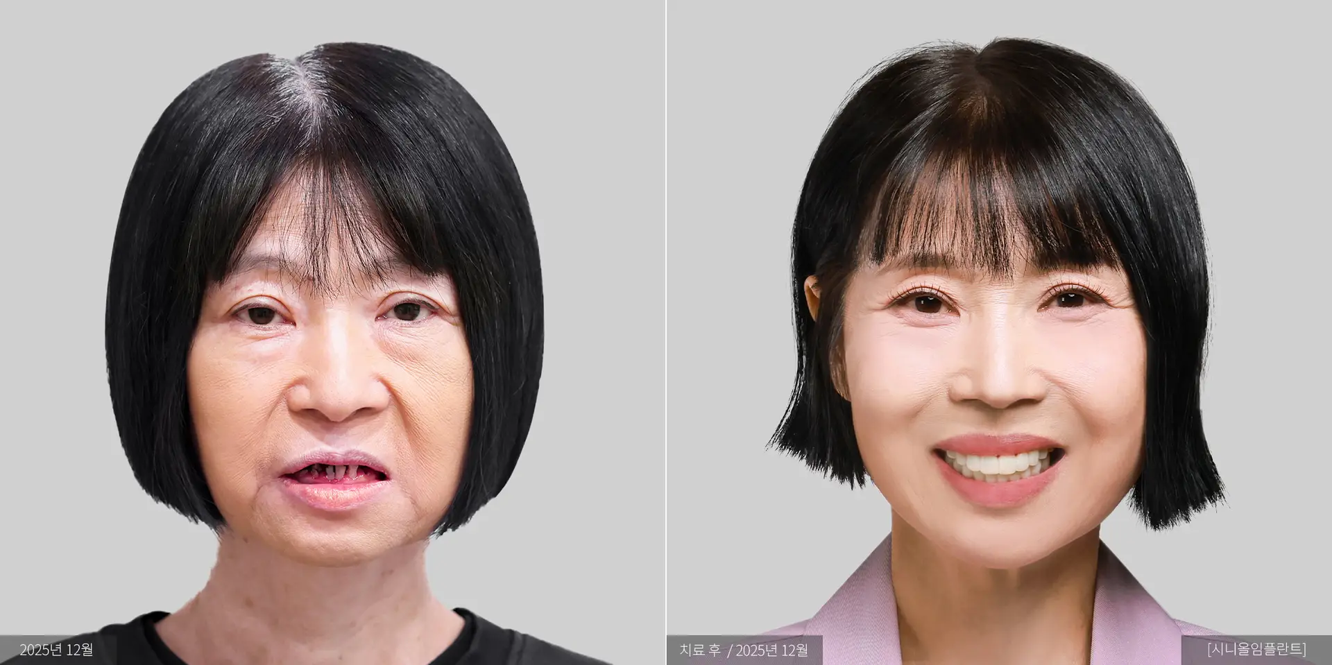 정미경 전후 사진