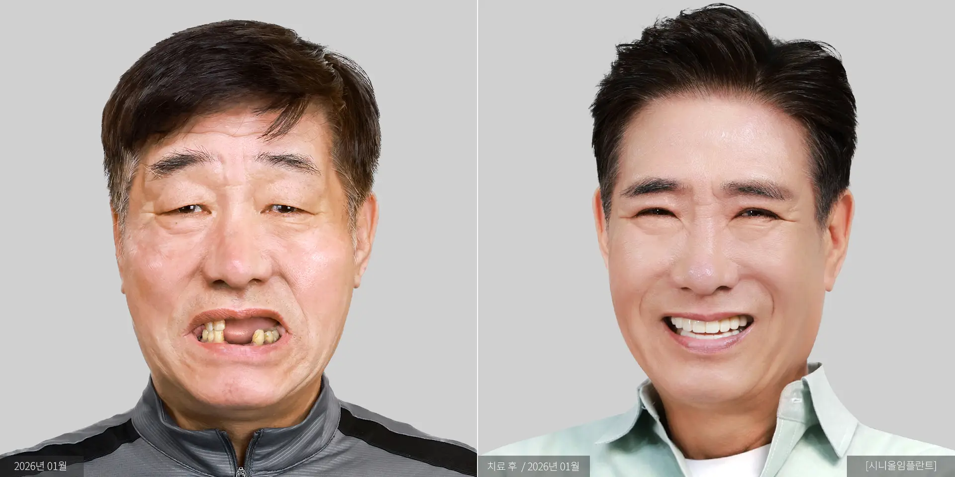 최효남 전후 사진
