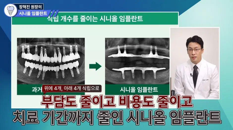 식립 개수를 줄여 환자의 부담과 비용, 치료 기간을 단축하는 시니올 임플란트의 X-ray 전후 비교 화면을 설명하는 장혁진 원장